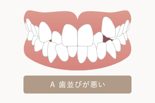 歯並びが悪い